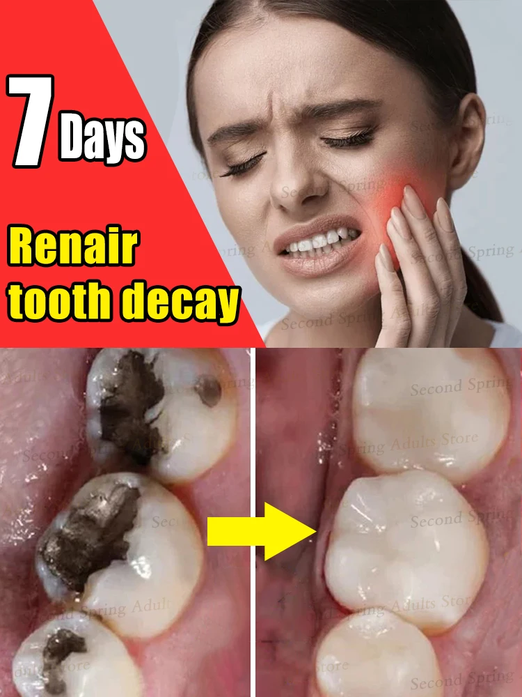 

2025 Bestseller Tooth Mousse repair tooth decay removal Unisex