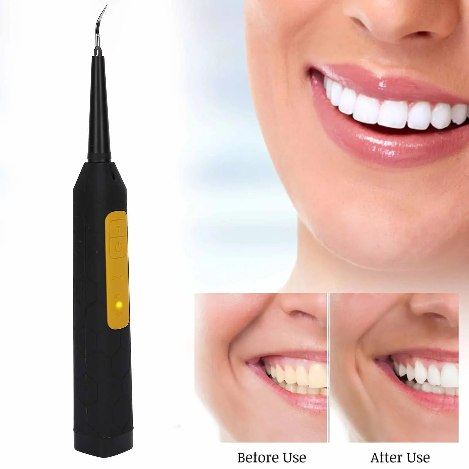 Limpiador de dientes con cabezal de acero inoxidable de alta calidad, eliminador de cálculo eléctrico, eliminador de sarro y dientes portátil, herramienta de cuidado bucal con carga USB