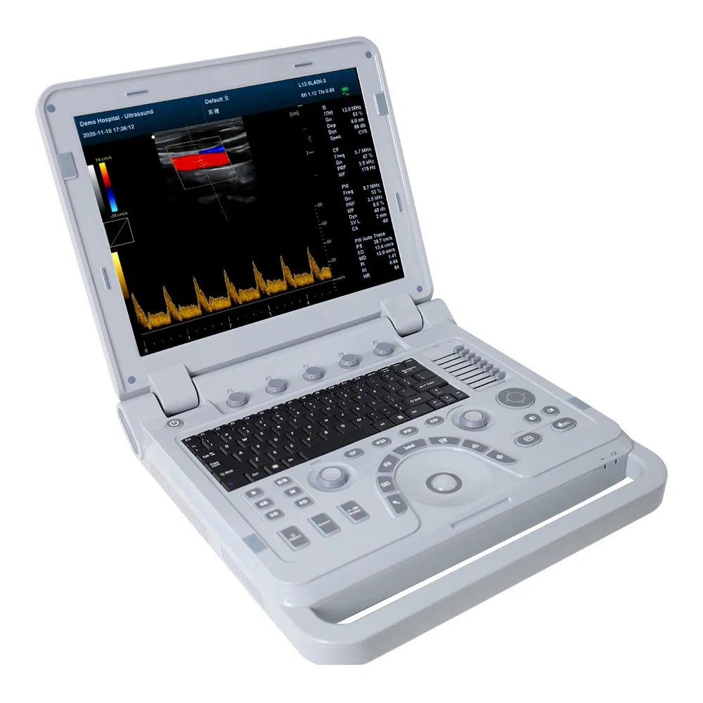 CONTEC CMS1700B Professional Diagnostic  cardiology ultrasound cardiology color doppler