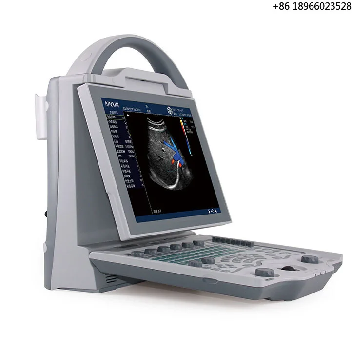 

2022 Price for sale Portable Full Digital Medical Ultrasound Instruments Wireless Ultrasound Scanner Portable Ultrasound Machine