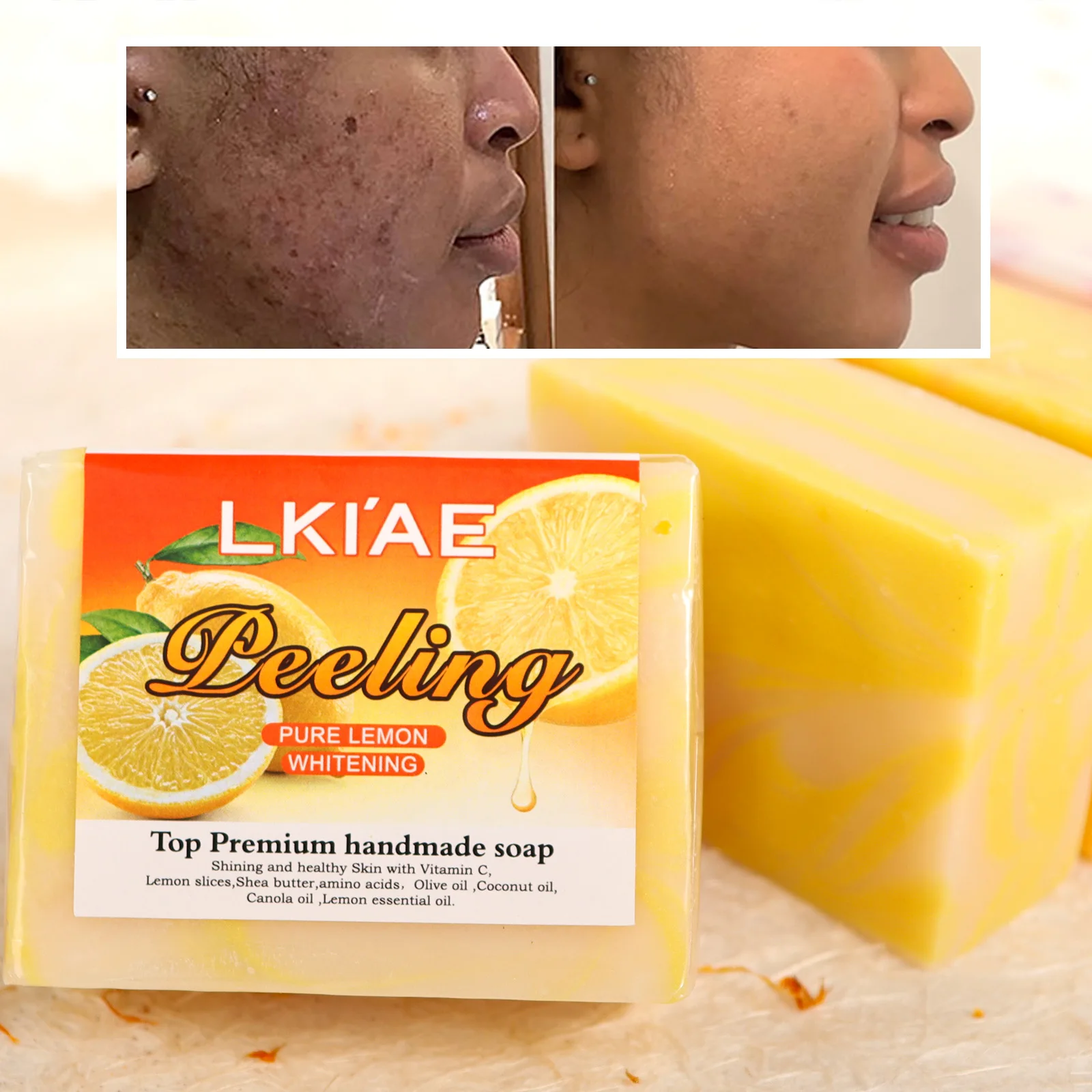 

LKIAE Organic Lemon Cold Processed Soap, Brightening, Moisturizing, With Vitamin C, Kojic Acid, Anti Acne and Dark Spots