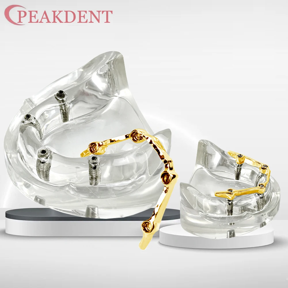 

Модель зубного имплантата с протезом-накладкой для восстановления зубов верхней челюсти, съемная модель имплантата для обучения и исследований стоматологов