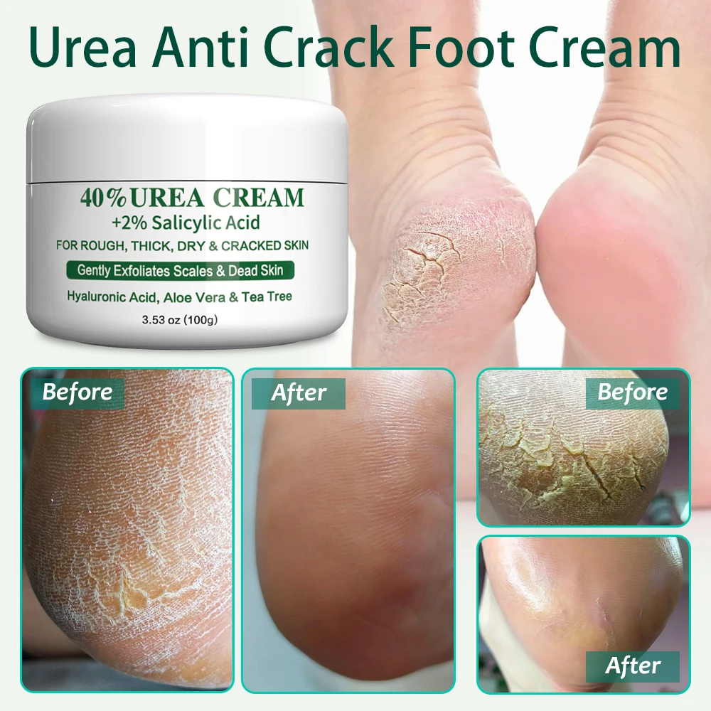 100g Urea Anti Crack Foot Cream Heel Cracking Repair Cream Removal Dead Skin Hand Moisturizing Exfoliating Softening Heel Mask