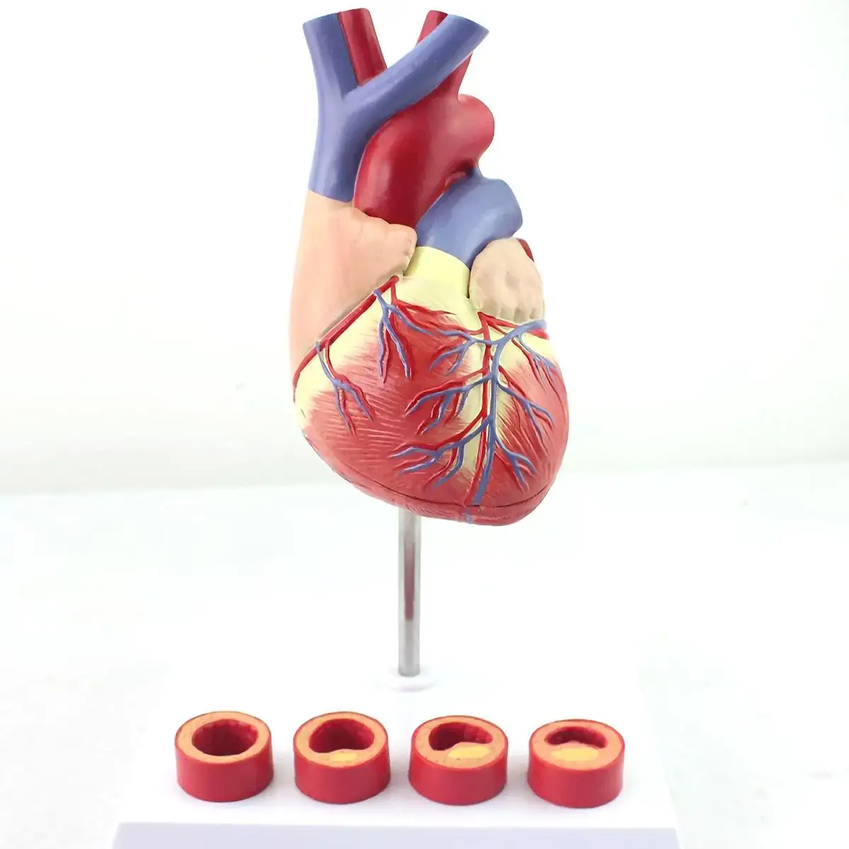 

6 Parts Life Size Human Heart With Thrombosis Model Medical School