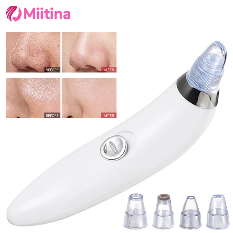 

Suction Blackheads Electric Blackheads Instrument Go Blackheads Face Pore Cleansing Radiant Facial Radiance Beauty Instrument