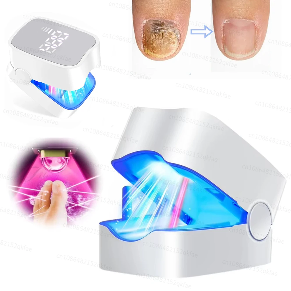 Nail Fungus Treatment LED Laser Device for Cleaning Onychomycosis USB Charge 905nm Infrared Light 470nm Blue Light Nail Salon