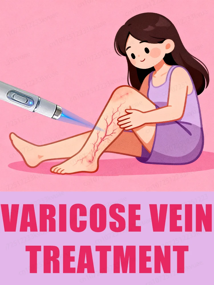 Geração-2 Laser diz adeus às varicosas das pernas de aranha em 7 dias