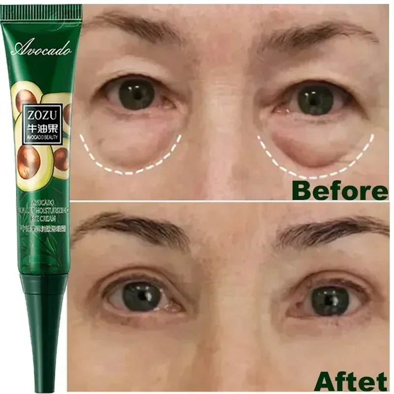 Quickly Remove Wrinkles Eye Cream Anti Dark Circles Bags Puffiness Fade Eye Fine Line Firming Lift Whiten Under Eyes Skin Care