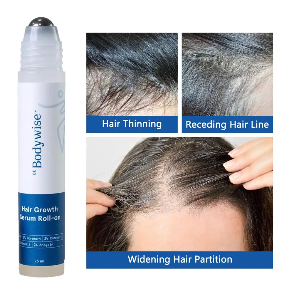 25ml natural alecrim cuidados com o cabelo essência bola reparar profundamente cabelos danificados hidratante reparação fortalecimento cuidados com o cabelo
