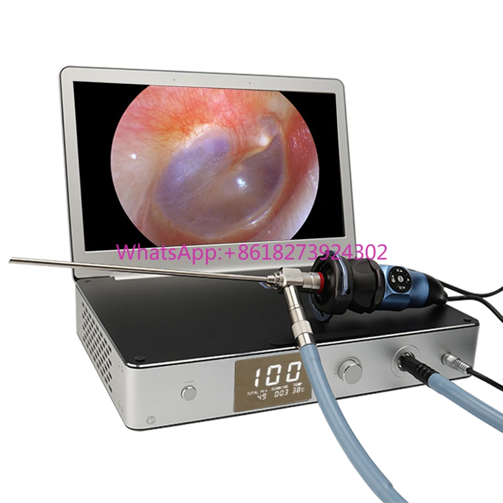 

Medical 1080P/30FPS HD Endoscopy Camera 30W LED Light Source 11.6" Endoscope Camera Medical for ENT Surgery