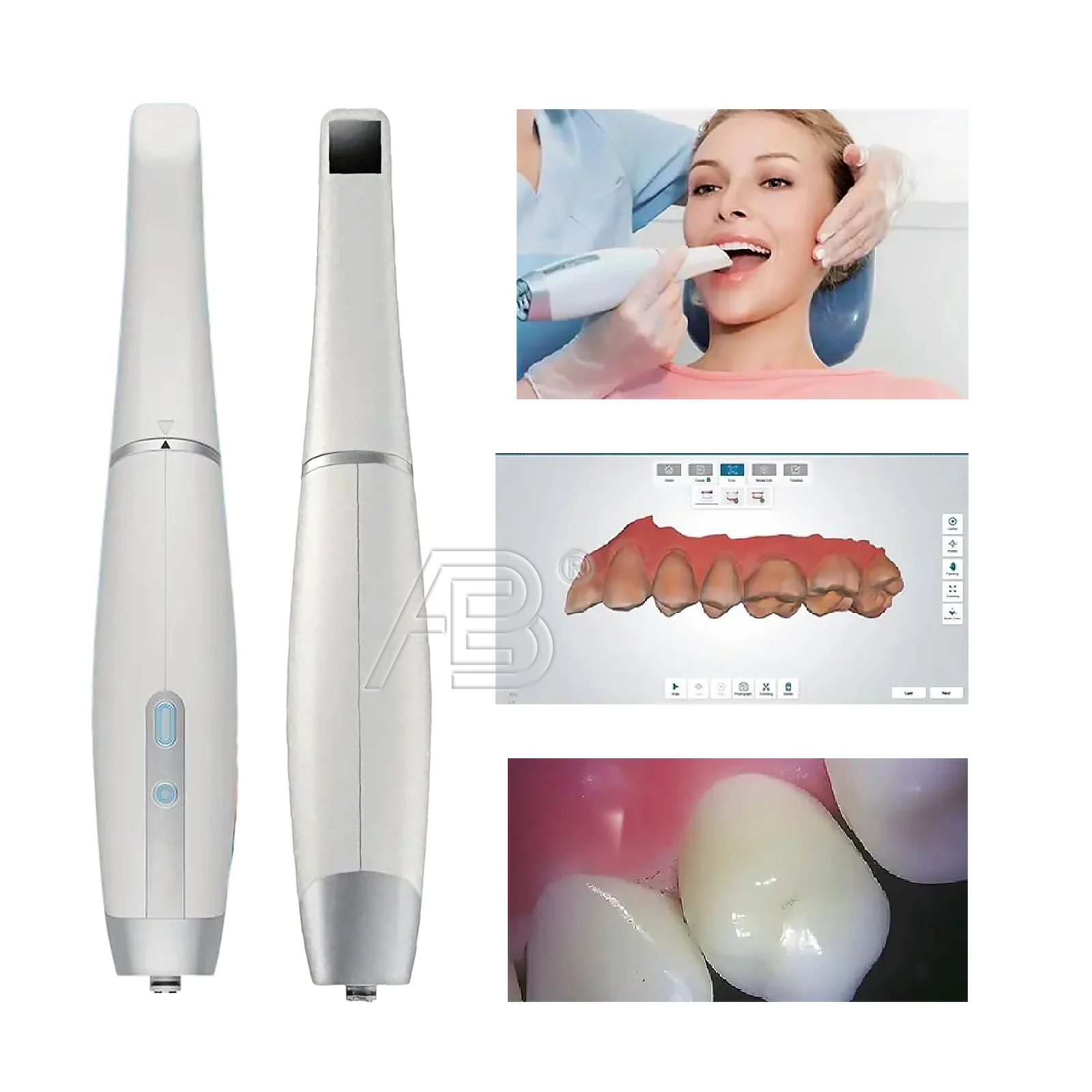 Dental Equipment Intra Oral Camera Scanner 3D Dental Handheld Digital 3D Intraoral Scanner With 5 Scanning Tips