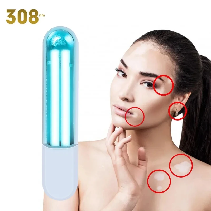 

308nm Narrowband Uvb Phototherapy Instrument Anti-Vitiligo Treatment Psoriasis Psoriasis White Spot Skin Uvb Lamp