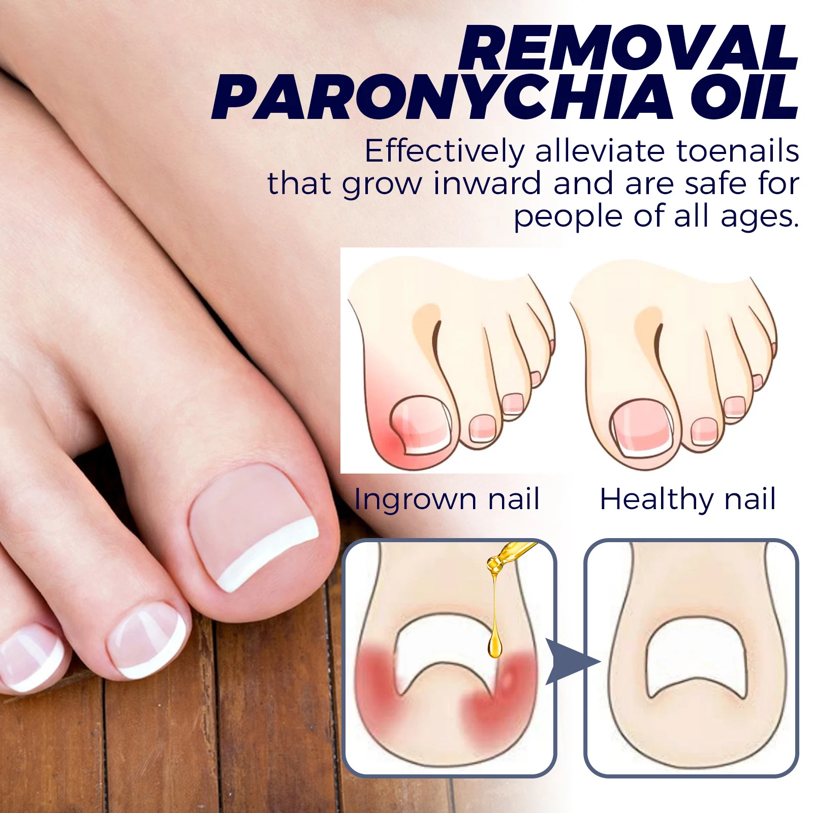 Foot Treatment Solution Professional Toe Nails Repair Nail Care Solution for Toenail