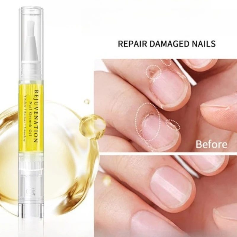 1 قطعة مسمار التغذية النفط القلم علاج الأظافر إهاب تنشيط تغذي مانيكير Nailfinger أدوات العناية إصلاح مسمار إهاب النفط القلم