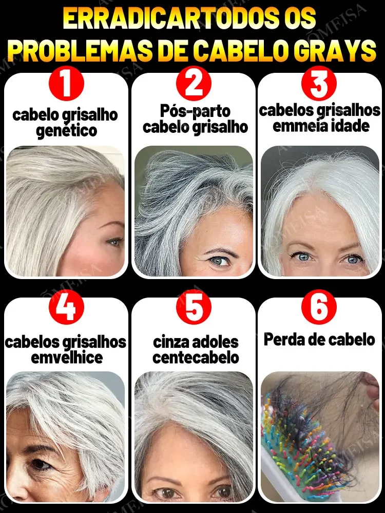 Suero para el tratamiento del cabello gris, blanco a negro, Color Natural, reparación, productos nutritivos, cuidado anticaída del cabello, hombres