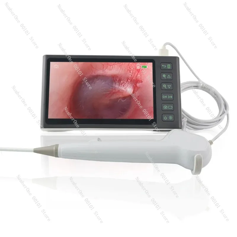

Portable Low-cost Otolaryngology Flexible Endoscopic Instrument Digital Video Bronchoscope with High Definition Medical Screen