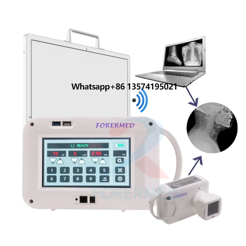 

Hospital Clinical XRay Machine DR Flat Panel Detector X-ray Radiology Equipment 2024 New Digital Handheld X Ray Machine