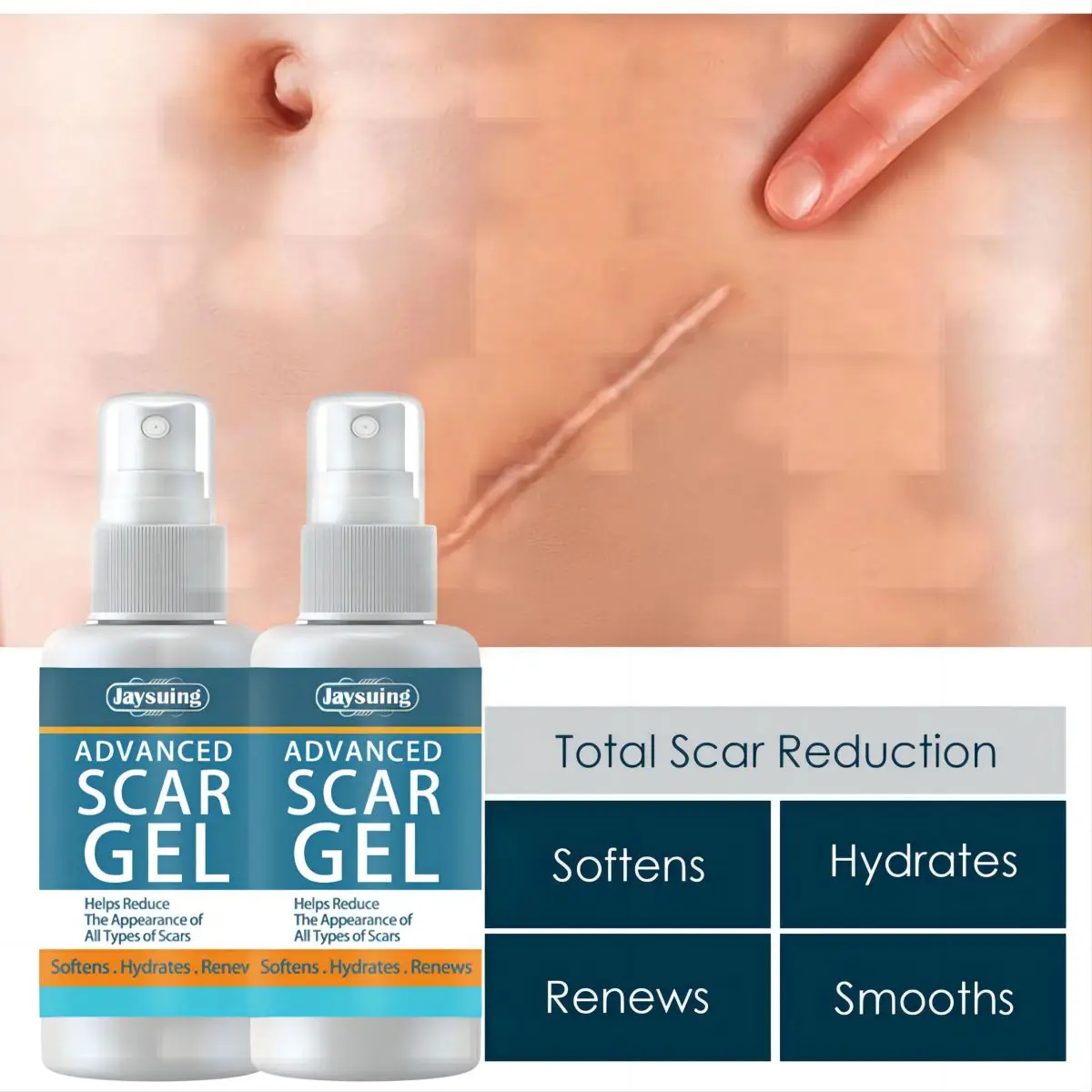 Jaysuing Fade Scar Cream Gel Skin Scar Repair Cream Postpartum Stretch Mark Narbchirurgie Glättet die Haut