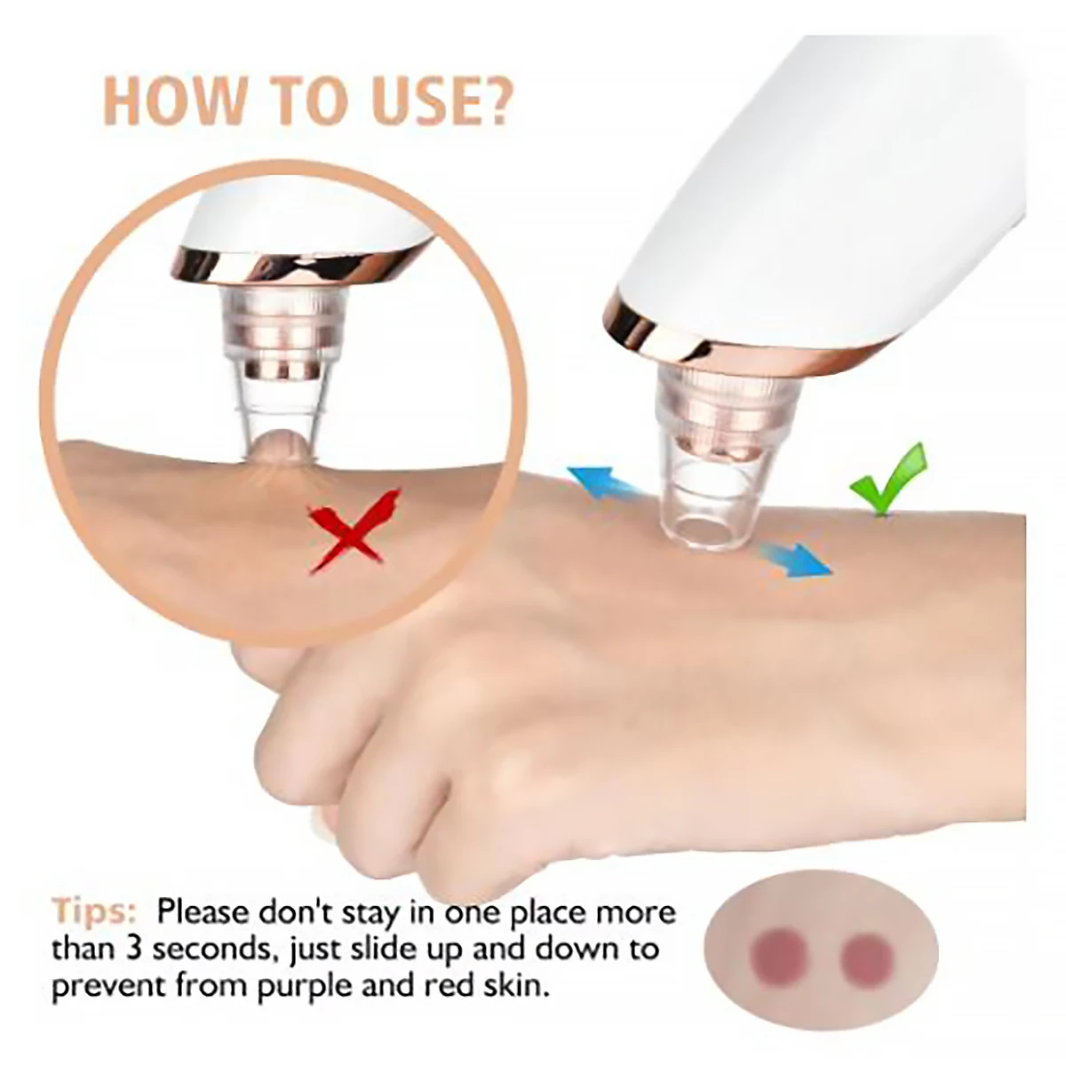 Blackhead Remover Pore Vacuum Face Cleaner Electric Pimple Acne Black Head Removal USB Rechargeable Water Cycle Black Dot Remove