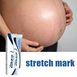 Maternity Cream That Enhances Elasticity, Gentle Skin Care After Pregnancy, Eliminates Stretch Marks, and Is Very Effective