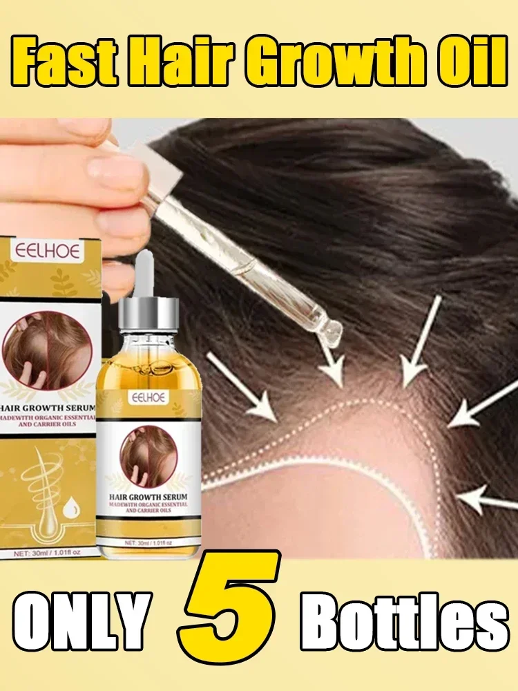 Óleo De Crescimento De Cabelo De Reparação Rápida, Perda De Cabelo Herbal, Seborréica Pós-parto, Cuidado Rápido Do Crescimento