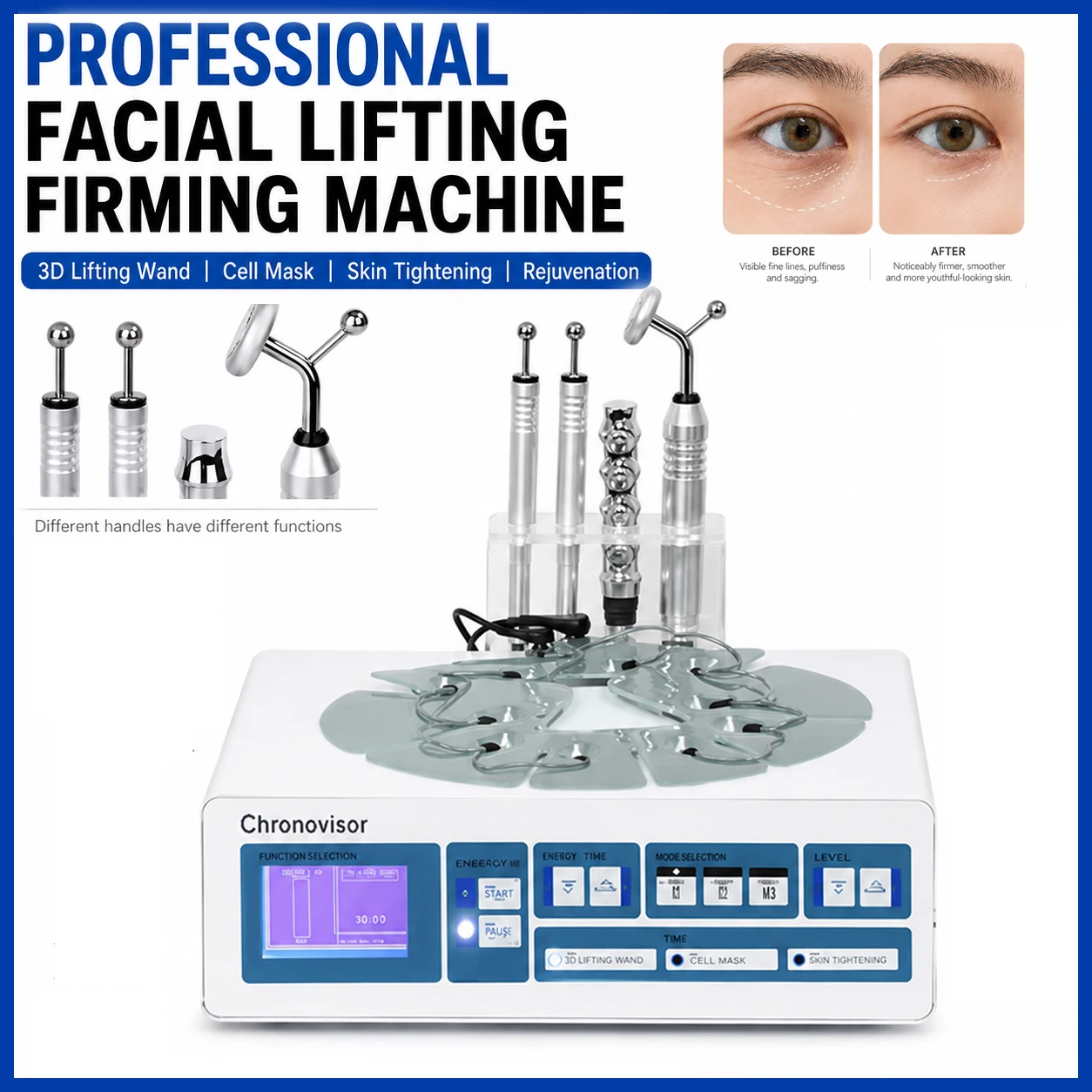 Professional RF Facial Lifting & Firming Machine – Skin Tightening & Rejuvenation Device, 3D Contouring Wand EMS Salon Clinic