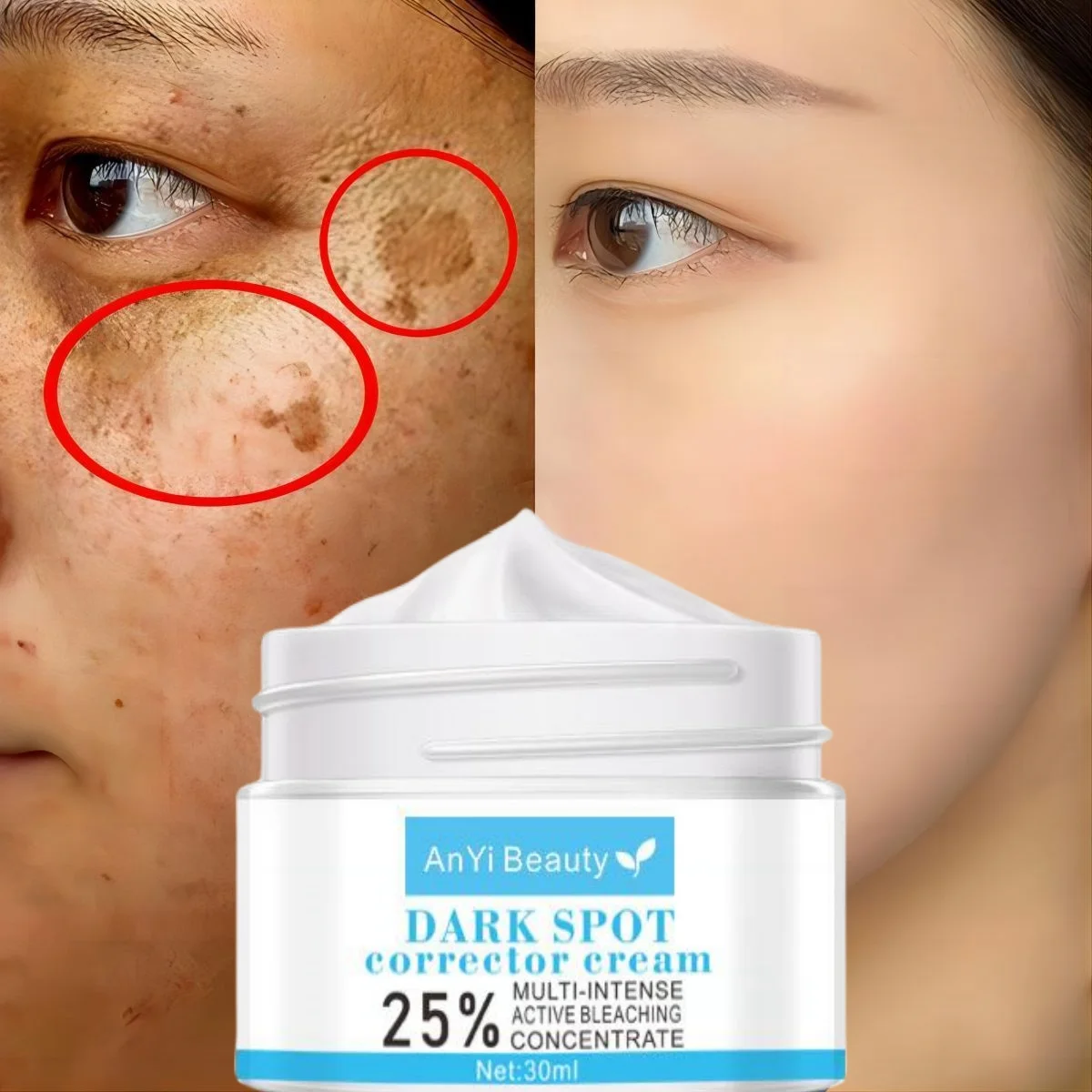 

Whitening Freckles Cream Remove Melasma Dark Spot Lightening Melanin Brightening Melasma Remover Moisturize Anti-aging Face Care