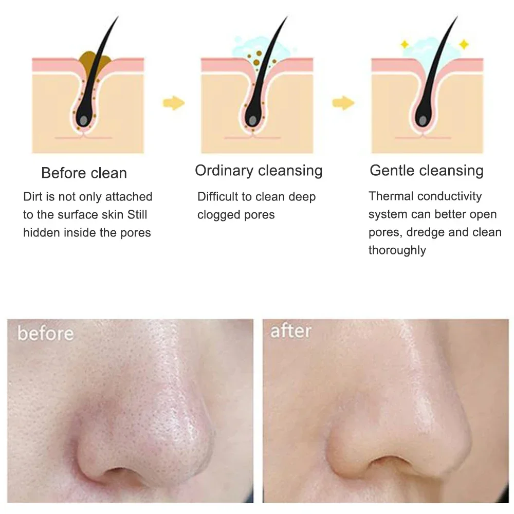 Brosse électrique de nettoyage du visage, outils de soins de la peau, étanche, Silicone, nettoyant sonique pour le visage