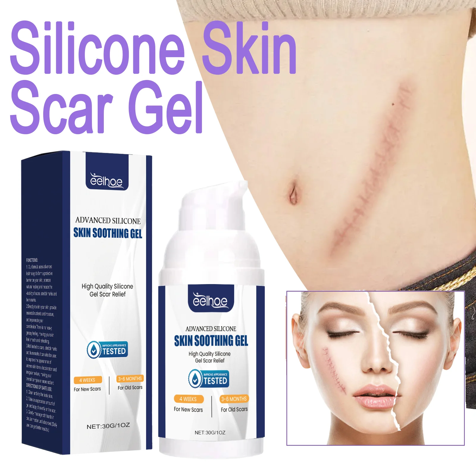 EELHOE Gel de silicona para cicatrices de la piel, Retinol, niacinamida, cicatrices, estrías, marcas de quemaduras, nutre profundamente la piel, Reduce el enrojecimiento, hinchazón, 30g