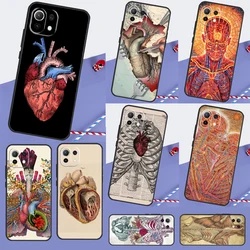 Medical Human Anatomy For POCO F5 X3 X4 X5 Pro F3 F4 GT M5s C40 Case For Xiaomi 13 12 Lite 12X 11T 12T Pro Cover