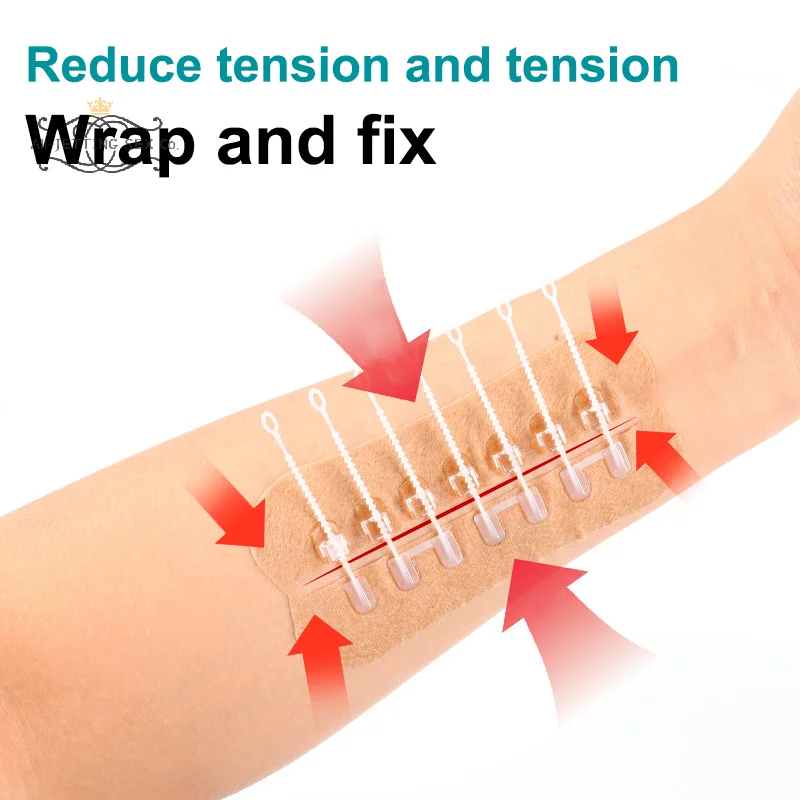 1 قطعة سستة التعادل الجرح إغلاق التصحيح مرقئ التصحيح الجرح سريع دون خياطة سستة في الهواء الطلق الفرقة المعونة المحمولة جلطة سريعة الجرح