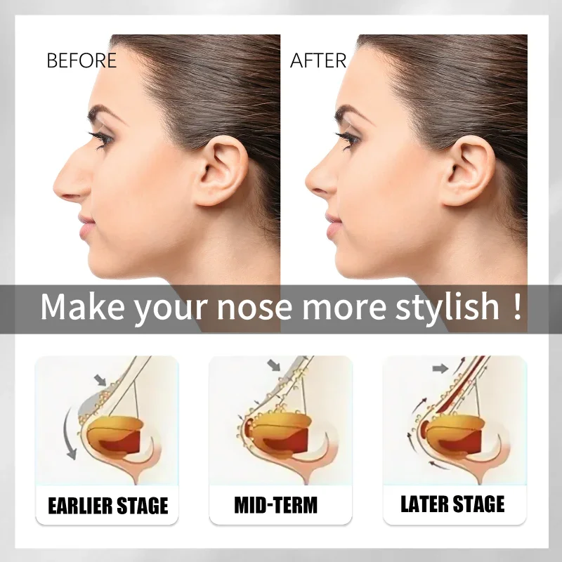 Nose Lift Up Essential Oil Heighten Rhinoplasty Oil Nose Up Heighten Rhinoplasty Pure Natural Care Thin Smaller Nose Care