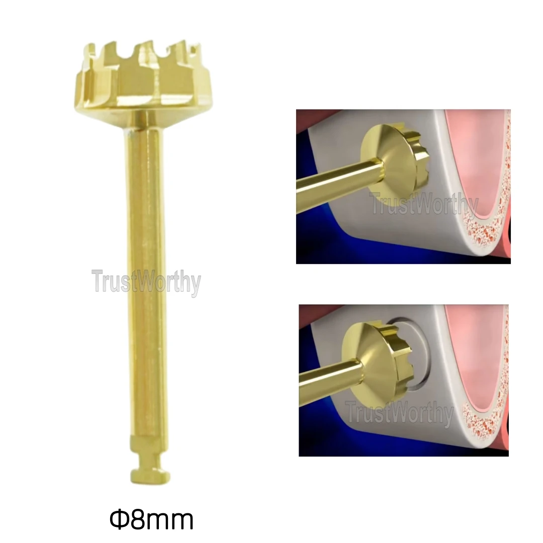 Φ8mm Dental Gear Cutter Drills Lateral Approach Sinus Lift Implant Burs ITI Straumann