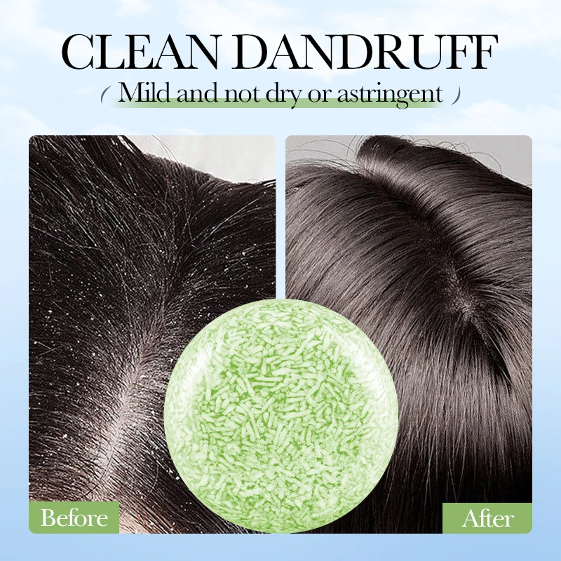 صابون شعر شجرة الشاي من SADOER، شامبو صلب للتحكم في الزيت، مضاد للقشرة، تنظيف عميق، إصلاح الشعر الجاف التالف، شامبو الشعر الناعم #6