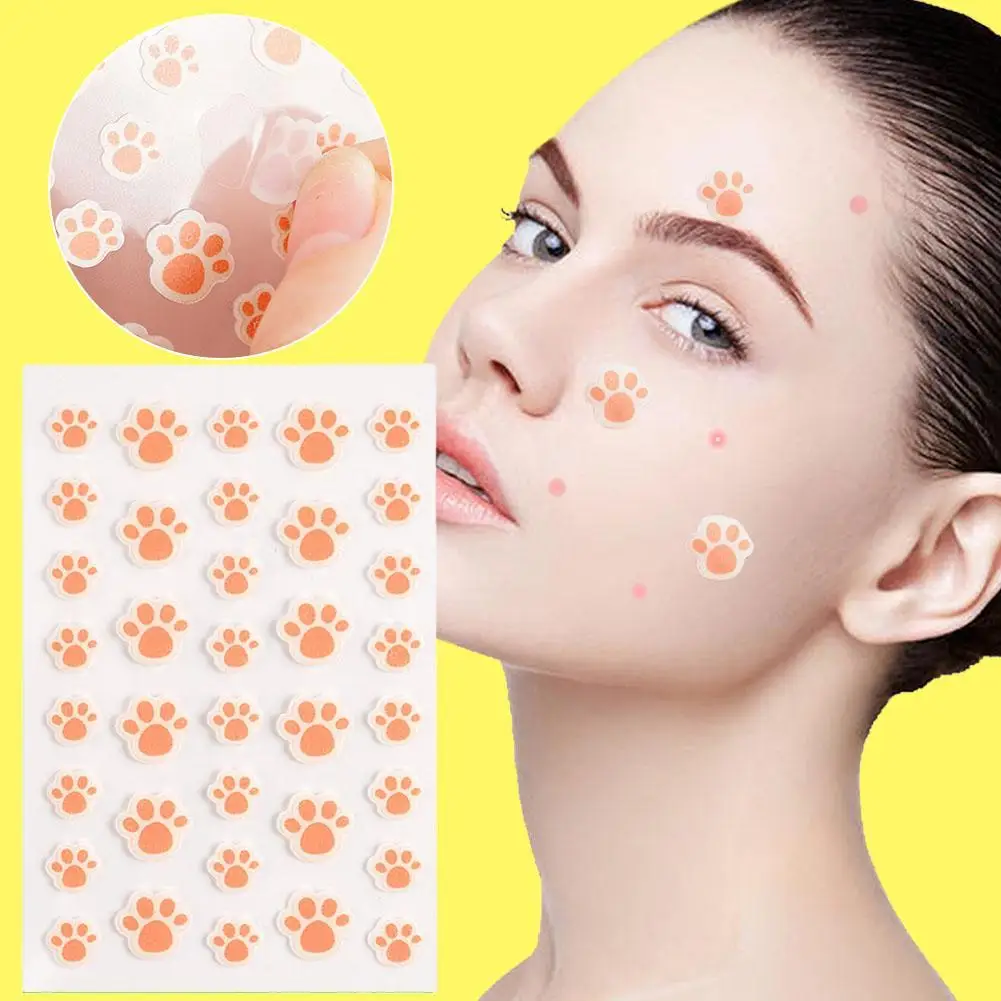 2pcs Cat Paw Pattern Acne Patch With Water-based Gel For Acne Removal And Fading Acne Marks Cute Facial Care Acne Patch