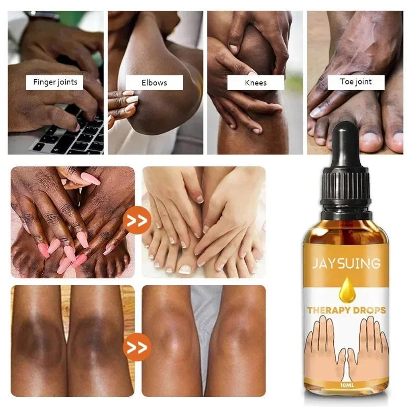 Black Knuckles Fast Brightening Serum Hand Knuckle Elbows Knee Intense Stains Remover Essence Dark Skin Pigmentation Correctors