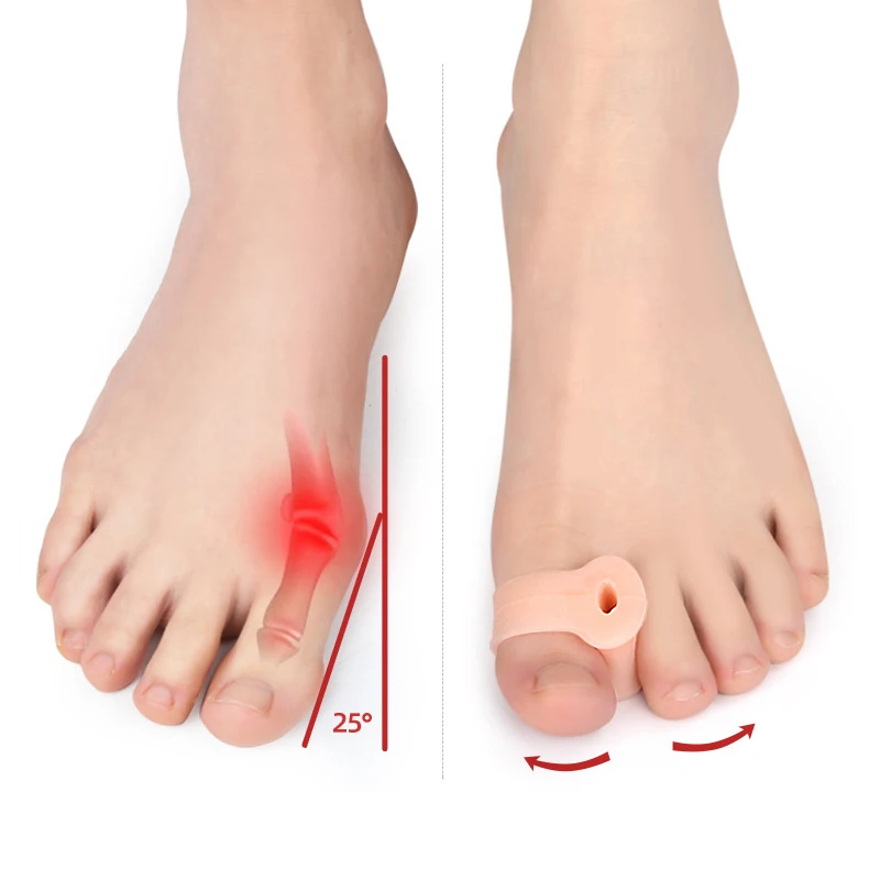 발 관리 실리콘 발가락 분리기 조절기, 젤 엄지 스페이서, 보호대 Bunions 무지 외반 교정기, 교정 교정, 2 개 = 1 쌍