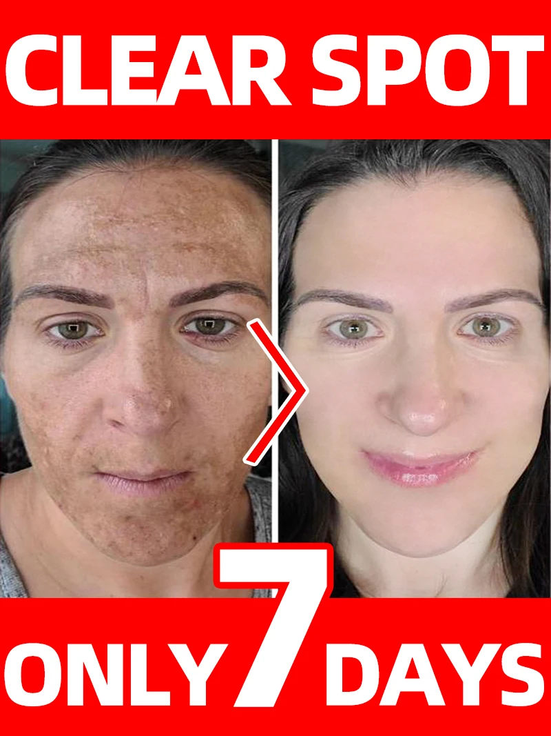 Gesichtsflecken verschwinden