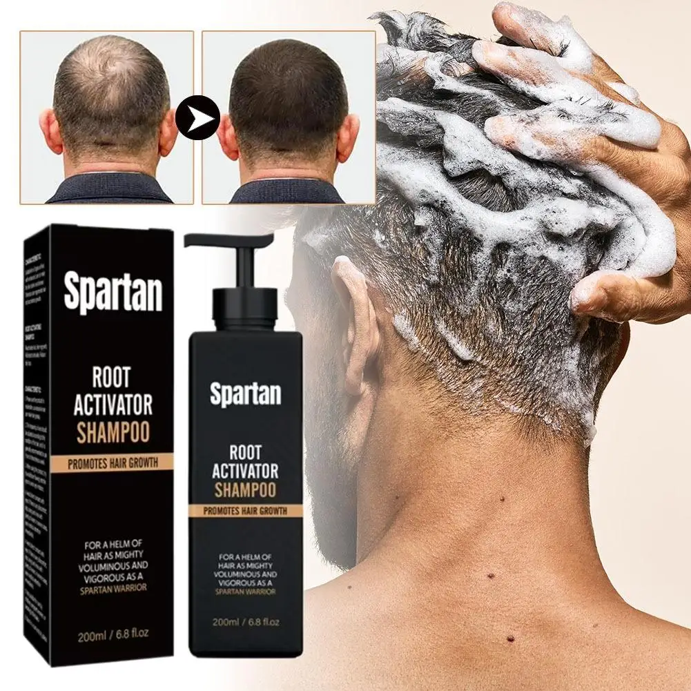 

Шампунь-активатор спартанского корня против выпадения волос, восстановление роста волос, не раздражающий пушистый питательный шампунь, средство для ухода за волосами