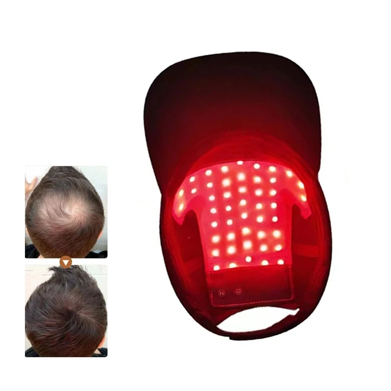 LED Red Light Therapy Cap Hair Growth Helmet Diode LaserHat Light Therapy Cap for Hair Regrowth and Hair Loss Treatment