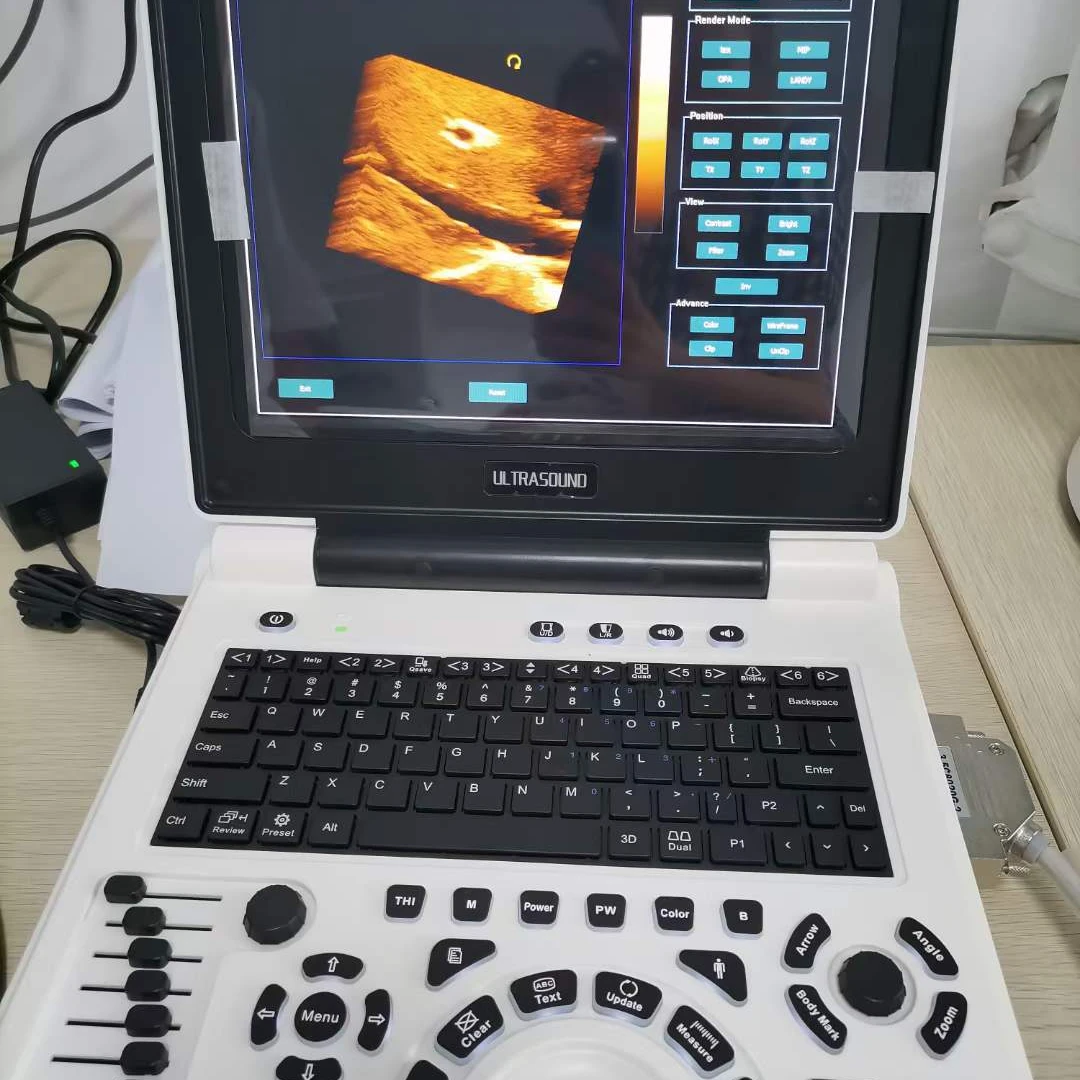 cheap Xianfeng e20 ultrasound scanner portable color doppler 3d portable ultrasound machine price