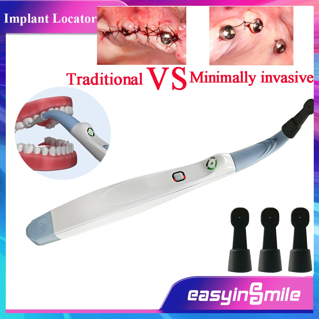 EASYINSMILE Wireless Dental Implant Abutments Locator Detector Smart Rotating 270° Spotting Sensor Motor Contrangle