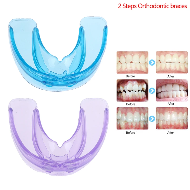 Apparecchio ortodontico dentale da 2 pezzi dispositivo di fissaggio dei denti correttore dei denti bretelle per allenatore