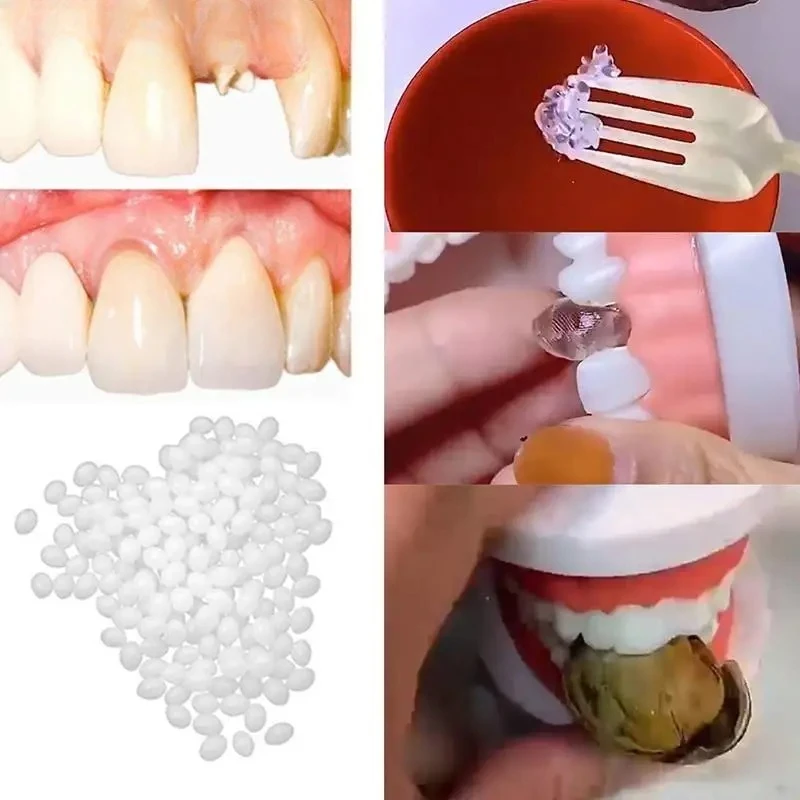 الراتنج 10 جرام/15 جرام/20 جرام الأسنان والفجوات كاذبة الأسنان الصلبة الغراء المؤقتة طقم تصليح الأسنان أسنان لاصقة تبييض الأسنان الجمال #5