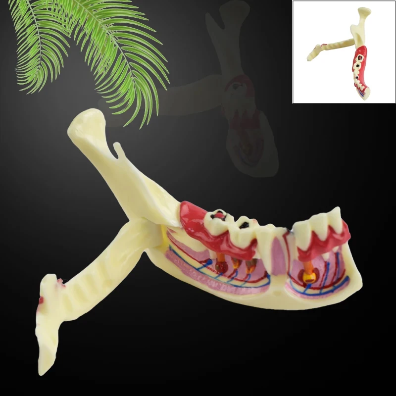 

Dental Endodontic Treatment Model Mandible Tissue Anatomical Model Anatomy of Gums Study Dental Materials teeth model