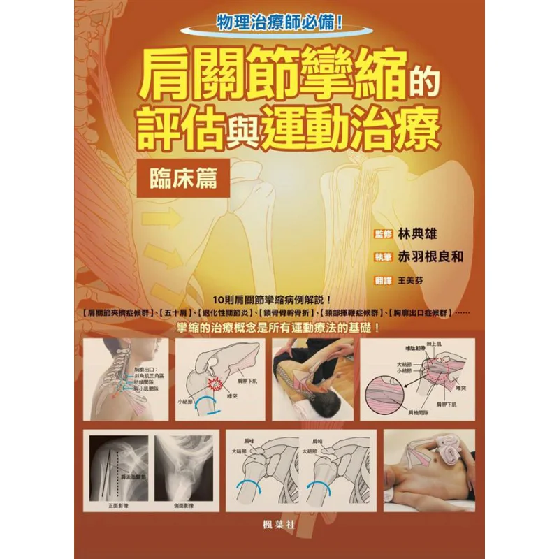 

Clinical Evaluation And Exercise Therapy For Shoulder Joint Contracture Ryoichi Akabane Maple Leaf Society 9789863702221 Book