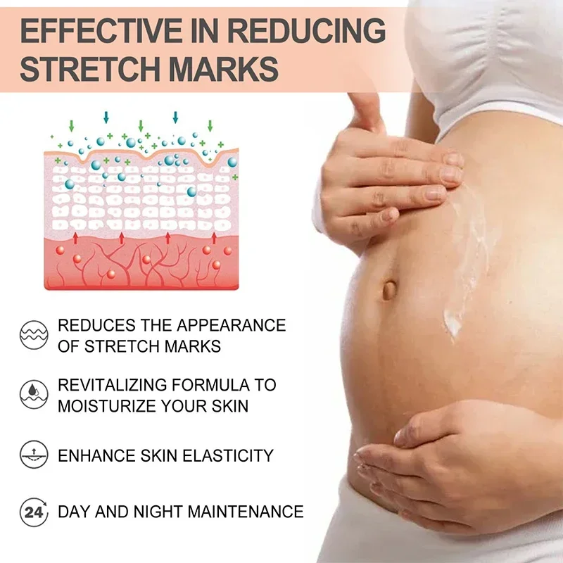 Remove Skin Cracks Repair Firming Care Stretch Marks Moisturize Cream Eliminate Body Belly Stretch Marks Removal Swelling Marks