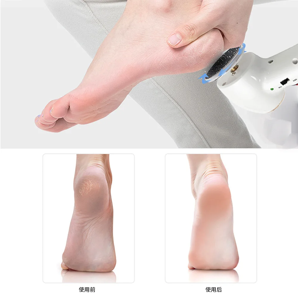 New USB Charging 2-speed Transfer To Remove Dead Skin Calluses, Dermabrasion Pedicure, Electric Pedicure