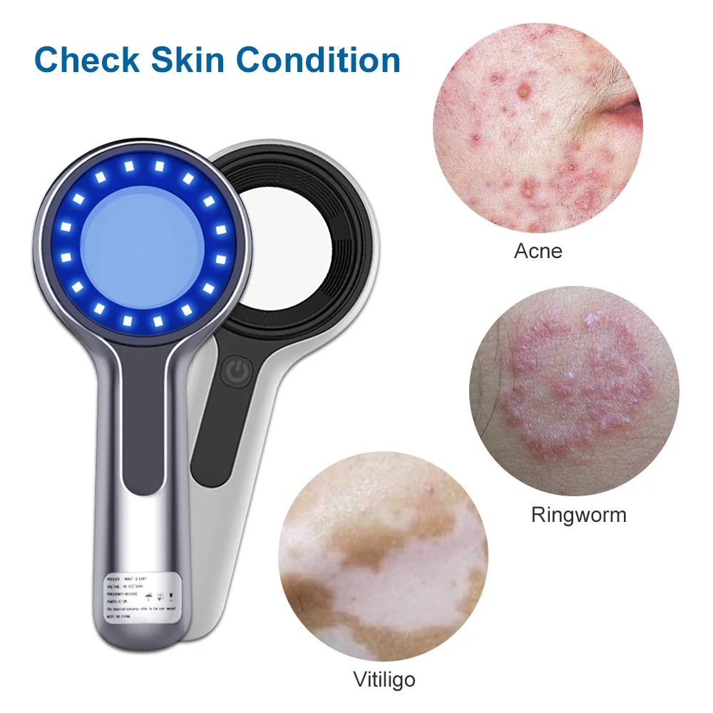 Woods Lamp Skin Analyzer For Skin UV Magnifying For Beauty Facial Testing Wood Lamp Light Skin Analysis Detection Skin Care