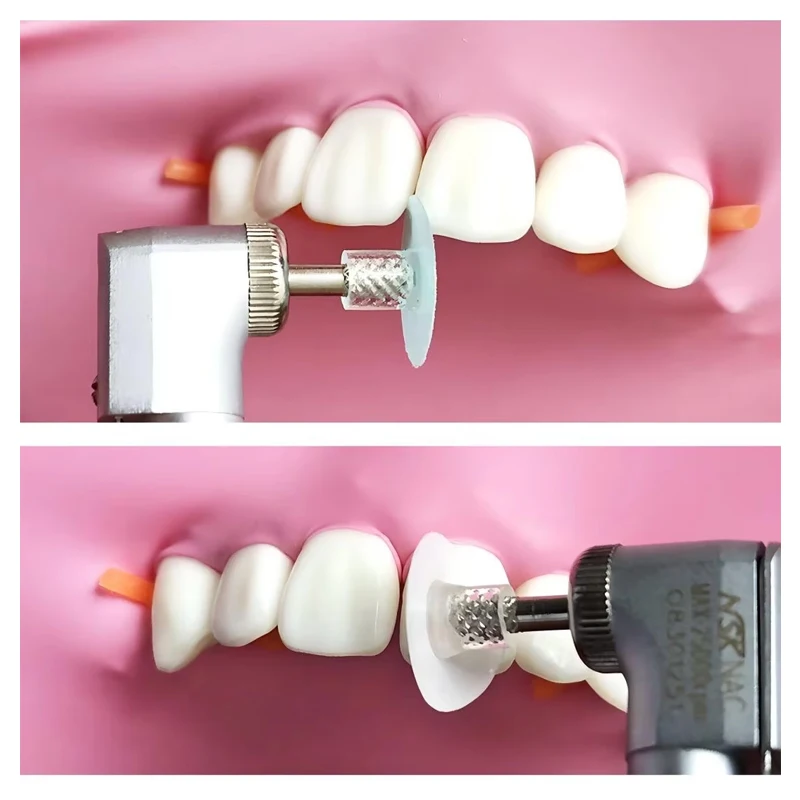 40Pcs Dental Polishing Disc Composite Resin Finishing Polishing Stem Disc Reduction Contouring Mandrel Teeth Whitening Dentistry view 4